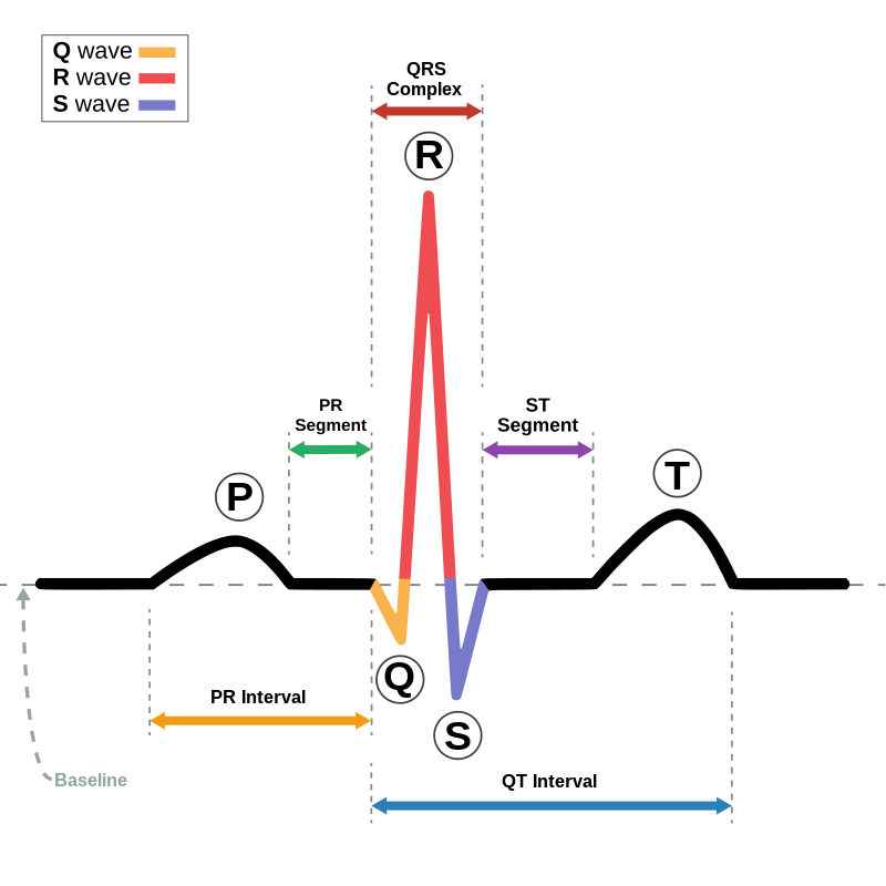 NLP Diagram of an ECG waveform labeled with P, Q, R, S, and T waves. Colored arrows indicate the QRS complex, PR segment, ST segment, PR interval, and QT interval—key phases in healing and recovery—while a dashed line marks the baseline. Hypnotherapy